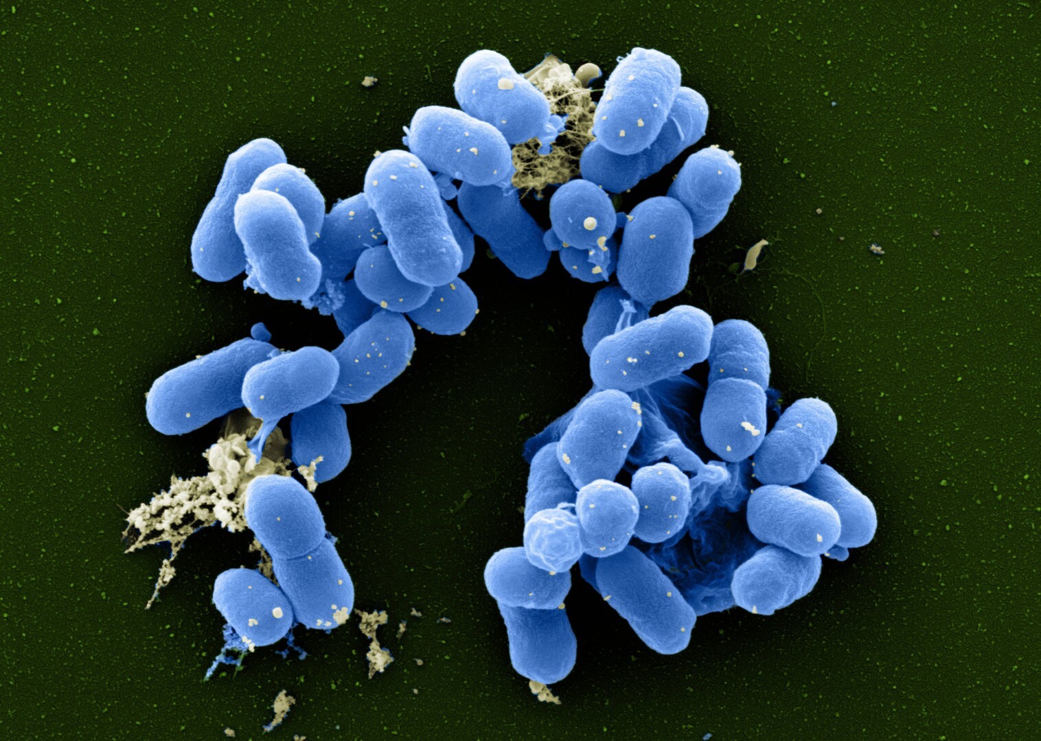 Unterfranken: Vereinzelte EHEC-Erkrankungen in der Region Unterfranken: Vereinzelte EHEC-Erkrankungen in der Region